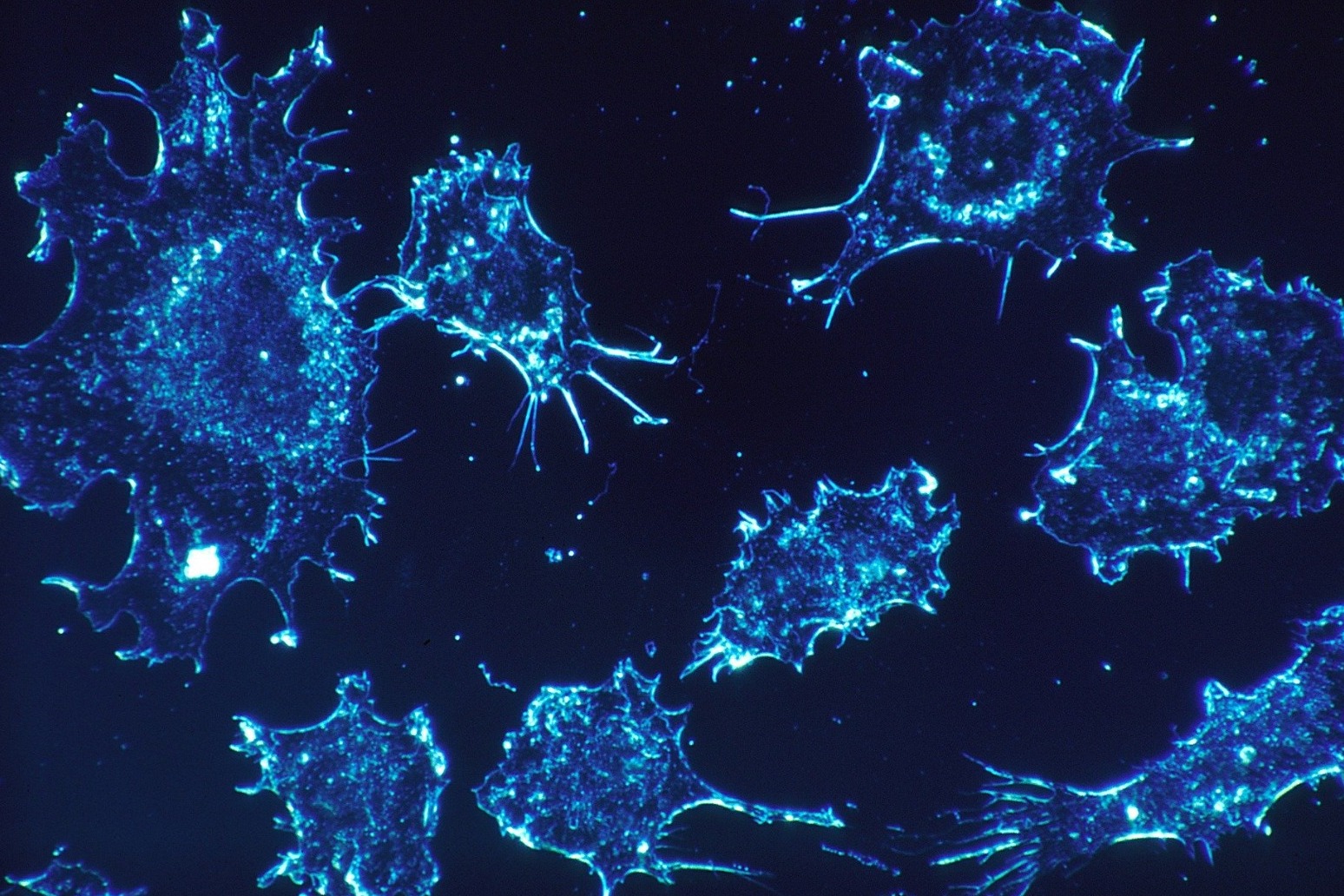 FOCUS ON CANCER \'CURE\' OVERSHADOWING PROGRESS MADE IN PROLONGING LIVES